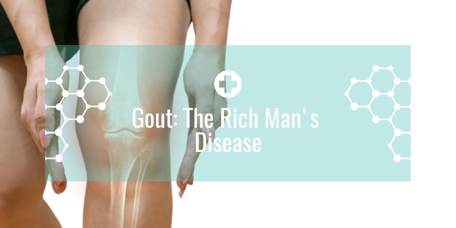 Gout: The Rich Man's Disease
