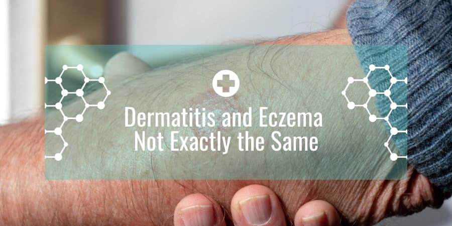 Dermatitis and Eczema Not Exactly the Same