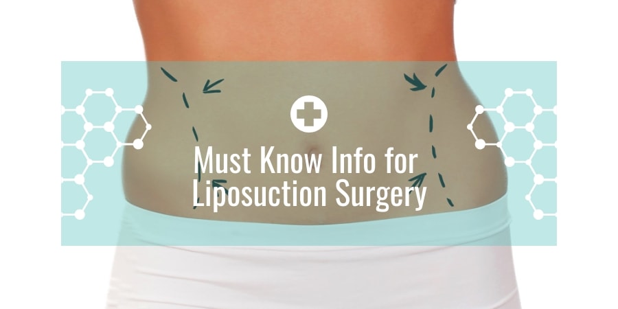 Must Know Info for Liposuction Surgery
