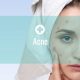Acne Problem, Prevention and Treatment