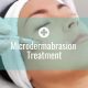 Microdermabrasion Treatment